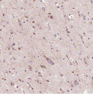 Immunohistochemistry: GLRB Antibody [NBP2-30683]