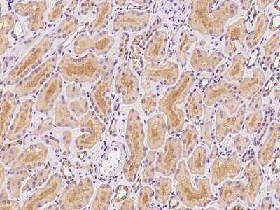 Immunohistochemistry-Paraffin: GLRB Antibody [NBP2-97806]
