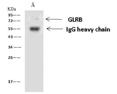 Immunoprecipitation: GLRB Antibody [NBP2-97806]