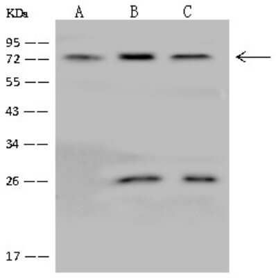 Western Blot: GLRB Antibody [NBP2-97806]