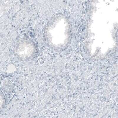 Immunohistochemistry-Paraffin: GLS2 Antibody (CL7716) [NBP2-88907]