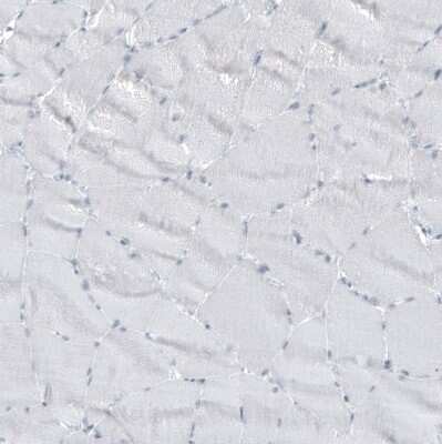 Immunohistochemistry-Paraffin: GLS2 Antibody (CL7716) [NBP2-88907]