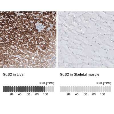 Immunohistochemistry-Paraffin: GLS2 Antibody (CL7716) [NBP2-88907]