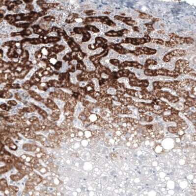 Immunohistochemistry-Paraffin: GLS2 Antibody (CL7721) [NBP2-88908]