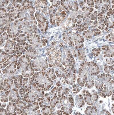 Immunohistochemistry-Paraffin: GLS2 Antibody (CL7721) [NBP2-88908]