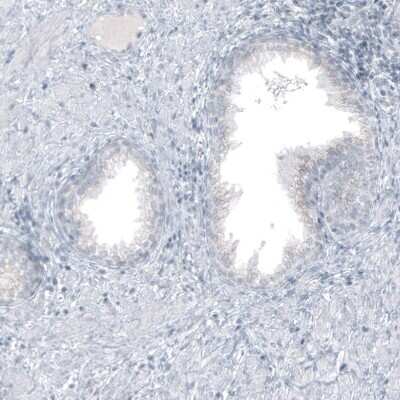 Immunohistochemistry-Paraffin: GLS2 Antibody (CL7721) [NBP2-88908]