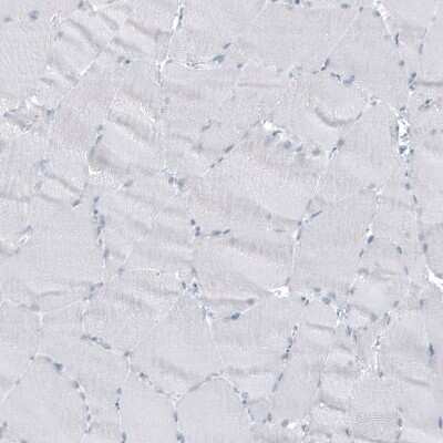 Immunohistochemistry-Paraffin: GLS2 Antibody (CL7721) [NBP2-88908]