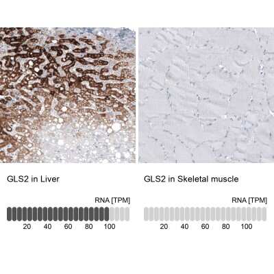 Immunohistochemistry-Paraffin: GLS2 Antibody (CL7721) [NBP2-88908]