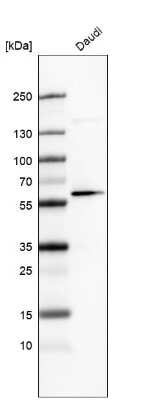 Western Blot: GLS2 Antibody (CL7721) [NBP2-88908]