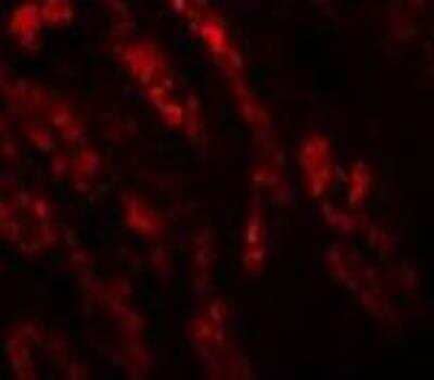 Immunocytochemistry/ Immunofluorescence: GLS2 Antibody - BSA Free [NBP1-76544]