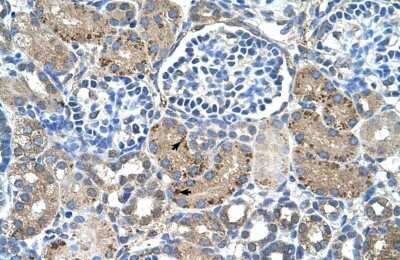 Immunohistochemistry: GLS2 Antibody [NBP1-54773]