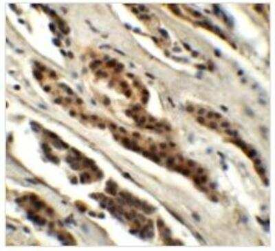 Immunohistochemistry: GLS2 Antibody - BSA Free [NBP1-76544]