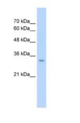 Western Blot: GLS2 Antibody [NBP1-54773]