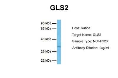 Western Blot: GLS2 Antibody [NBP1-54773]