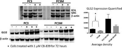 Western Blot: GLS2 AntibodyBSA Free [NBP1-76544]