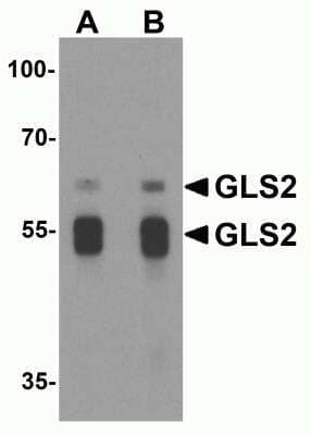 Western Blot: GLS2 AntibodyBSA Free [NBP2-82071]