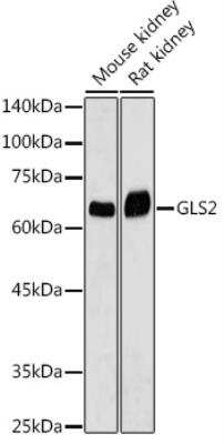 Western Blot: GLS2 AntibodyAzide and BSA Free [NBP3-04094]