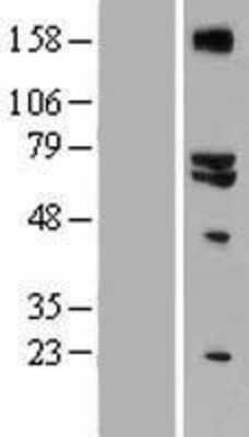 Western Blot: GLS2 Overexpression Lysate [NBP2-07429]