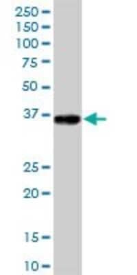 Western Blot: GLT1D1 Antibody [H00144423-B01P]