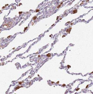 Immunohistochemistry-Paraffin: GLT25D1 Antibody [NBP2-14619]