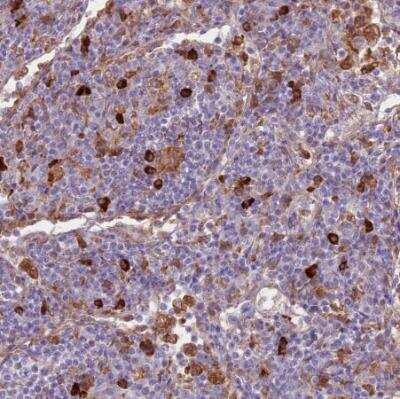 Immunohistochemistry-Paraffin: GLT25D1 Antibody [NBP2-14619]