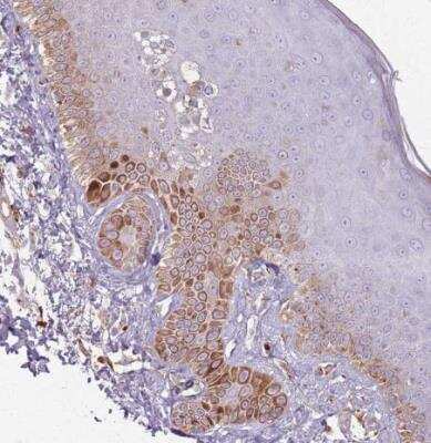 Immunohistochemistry-Paraffin: GLT25D1 Antibody [NBP2-14619]