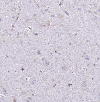 Immunohistochemistry-Paraffin: GLT25D1 Antibody [NBP2-14619]