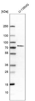 Western Blot: GLT25D1 Antibody [NBP2-14619]