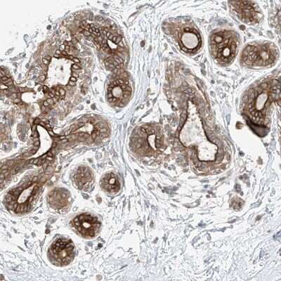 Immunohistochemistry-Paraffin: GLT25D2 Antibody [NBP1-90712]