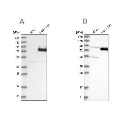 Western Blot: GLT25D2 Antibody [NBP1-90711]