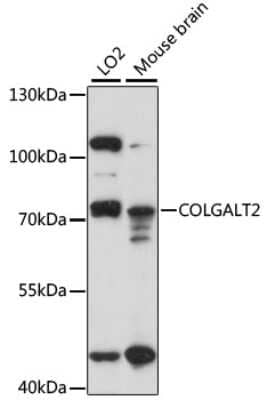 Western Blot: GLT25D2 AntibodyAzide and BSA Free [NBP3-03638]