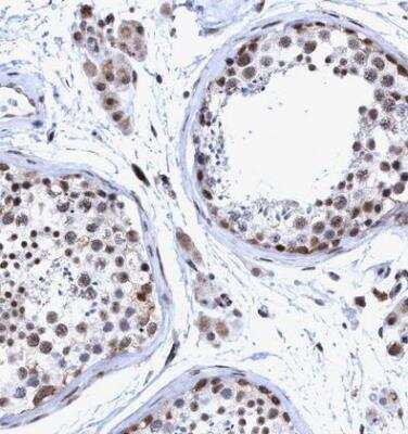 Immunohistochemistry-Paraffin: GLT6D1 Antibody [NBP1-81822]