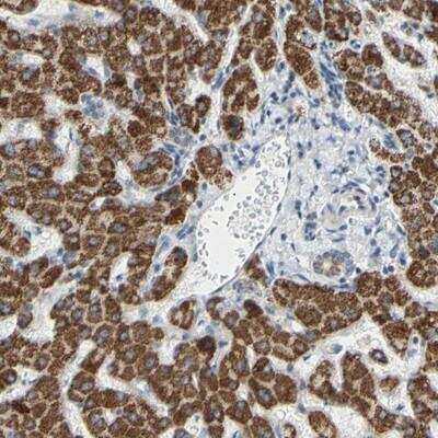Immunohistochemistry-Paraffin: GLT8D1 Antibody [NBP1-90872]