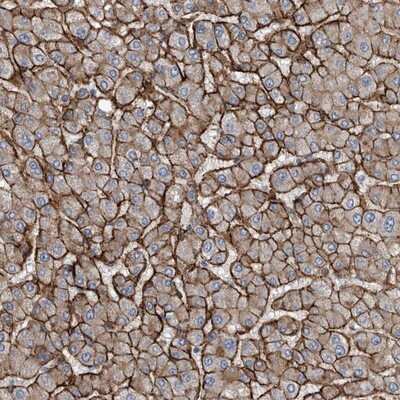 Immunohistochemistry-Paraffin: GLT8D2 Antibody [NBP1-83538]
