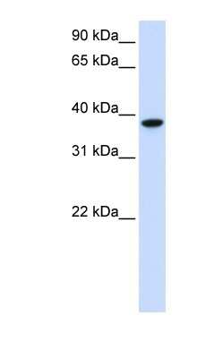 Western Blot: GLT8D2 Antibody [NBP1-62614]