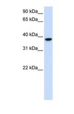 Western Blot: GLT8D2 Antibody [NBP1-69619]