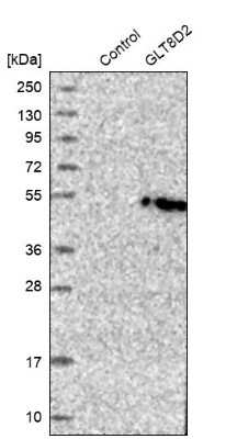 Western Blot: GLT8D2 Antibody [NBP1-83538]