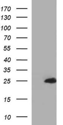 Western Blot: GLTP Antibody (OTI2A10) [NBP2-45875]