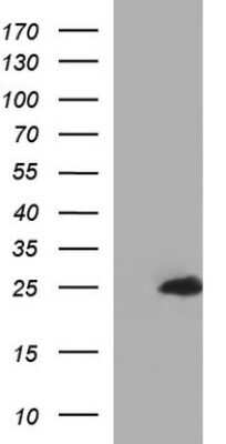 Western Blot: GLTP Antibody (OTI2A10)Azide and BSA Free [NBP2-71910]