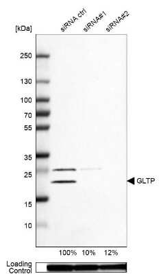 Western Blot: GLTP Antibody [NBP2-31642]