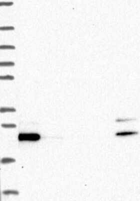 Western Blot: GLTP Antibody [NBP3-17497]