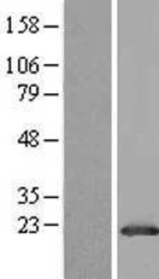 Western Blot: GLTP Overexpression Lysate [NBL1-11128]