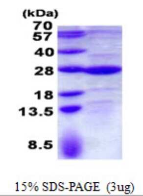 SDS-PAGE: Recombinant Human GLTP His Protein [NBP2-23081]