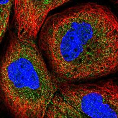 Immunocytochemistry/ Immunofluorescence: GLTPD1 Antibody [NBP2-30491]