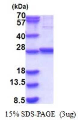 SDS-PAGE: Recombinant Human GLTPD1 His Protein [NBP2-51842]