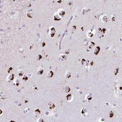 Immunohistochemistry-Paraffin: GLTPD2 Antibody [NBP2-34107]