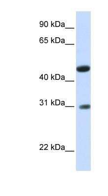 Western Blot: GLTPD2 Antibody [NBP1-80542]