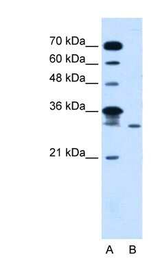 Western Blot: GLTPD2 Antibody [NBP1-80543]