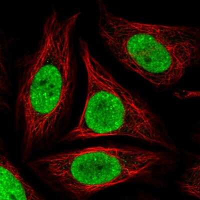 Immunocytochemistry/ Immunofluorescence: GLTSCR1 Antibody [NBP2-30603]