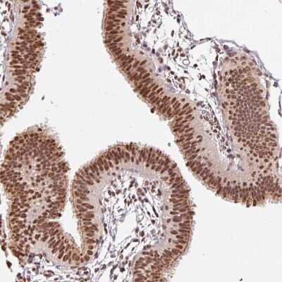 Immunohistochemistry-Paraffin: GLTSCR1 Antibody [NBP2-30603]